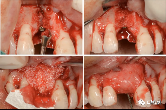 可手机商城搜索下载【口腔1刻】app或点击下方"阅读原文"!