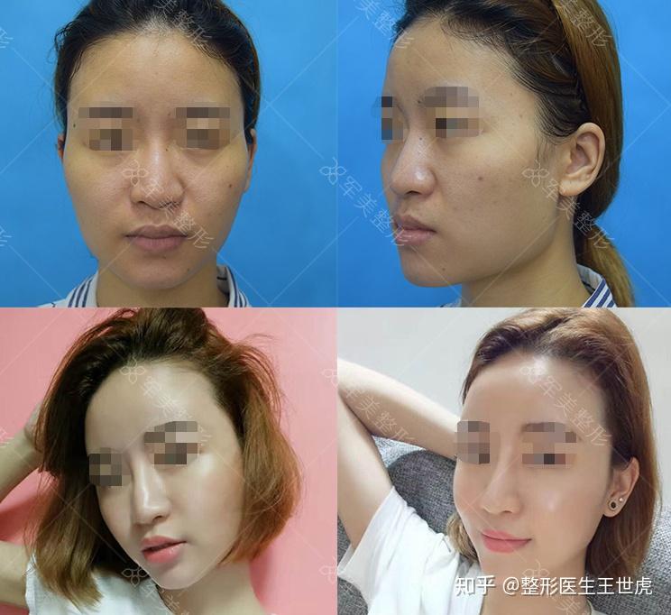 口罩怎么戴才好看高颜值 v2-221c528c80c2a789a852593390ff9995_r.jpg