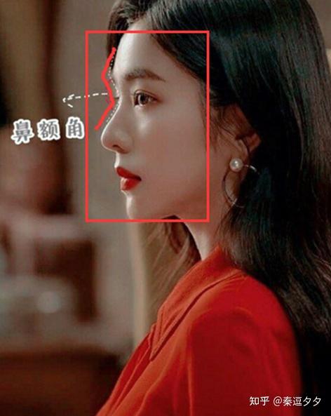 假体隆鼻10天后山根还是很高会变成通天鼻吗?