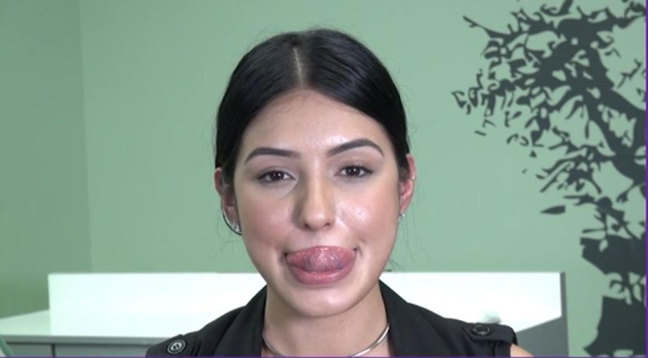 舌头上推练习重复10次吸住舌头在口腔上膛1