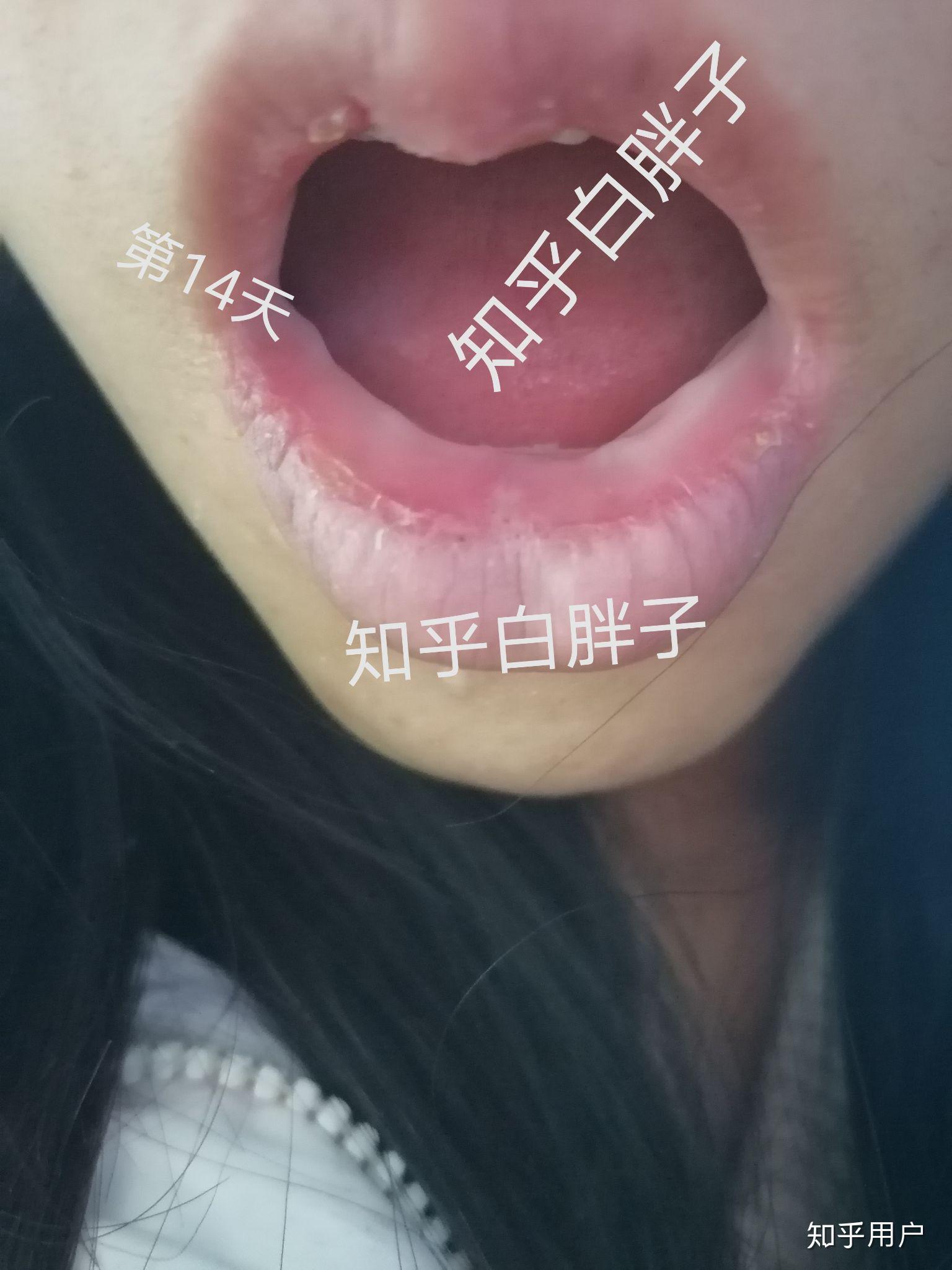 v2-22776da109b55c830066b64b2b4e17e9_r.jpg