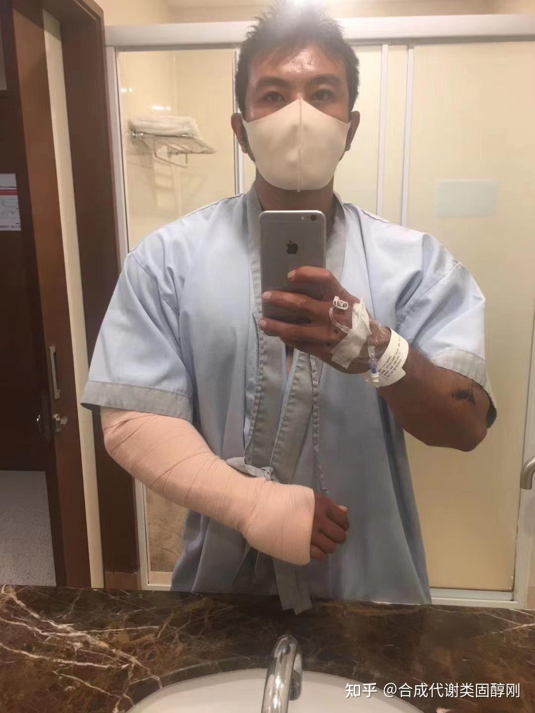 健体冠军李金英