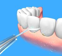 小米全家桶又憋大招了口腔清洁神器直白无线洁牙器分享