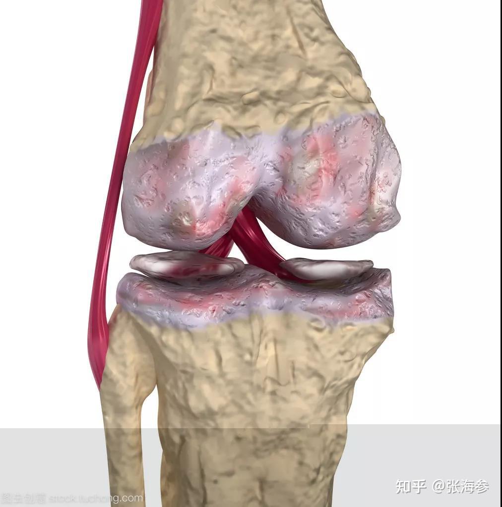 给钙流失的骨头补点肽有神奇效果