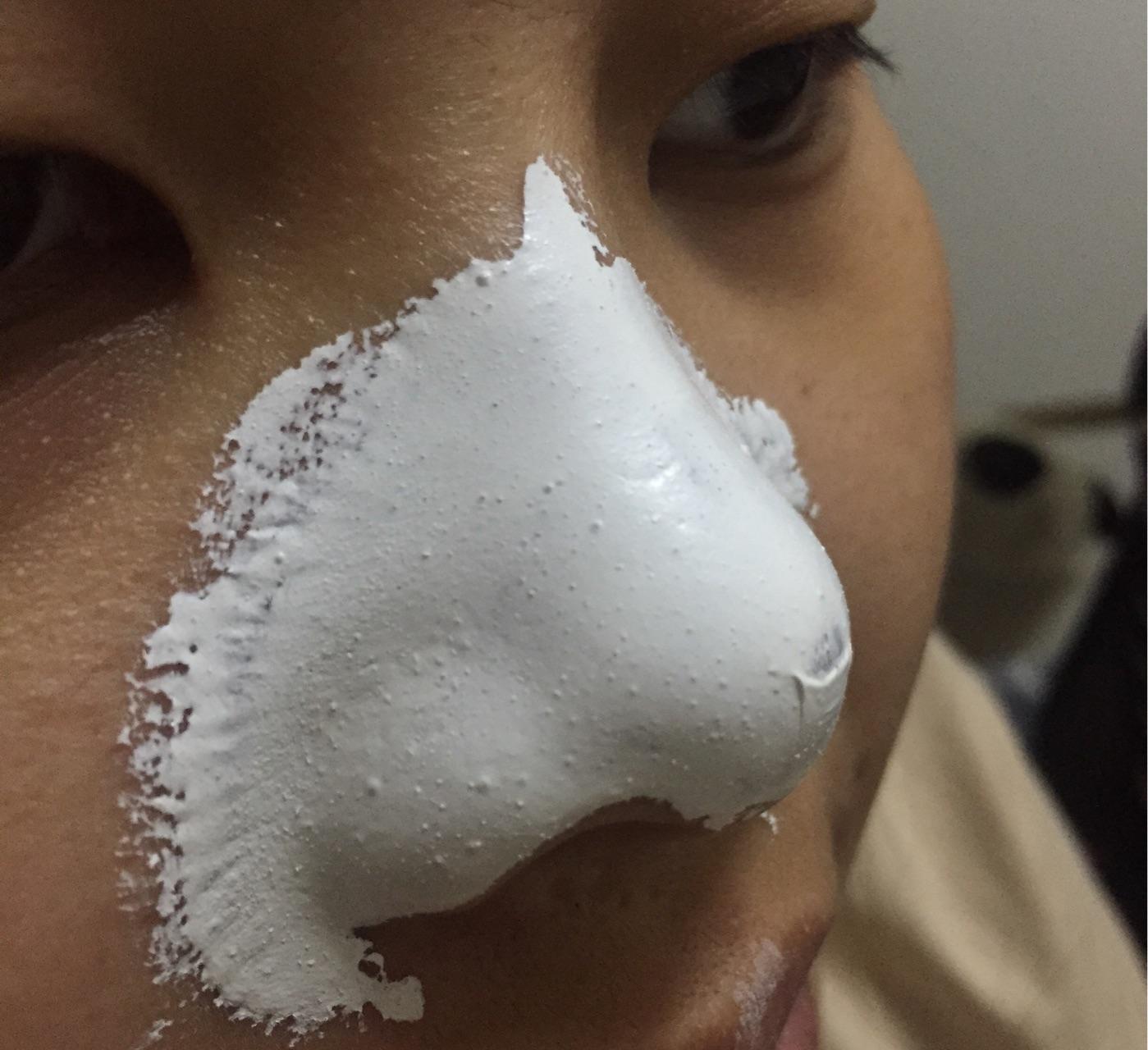 黑头粉刺巨恐怖怎么办?