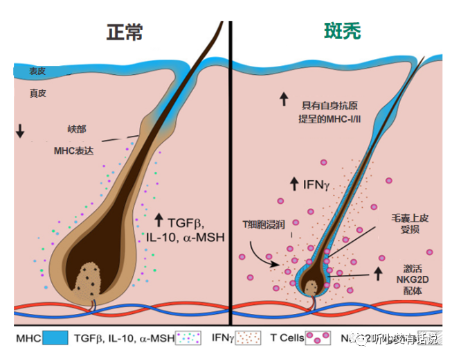 秃顶基因的遗传图解图片