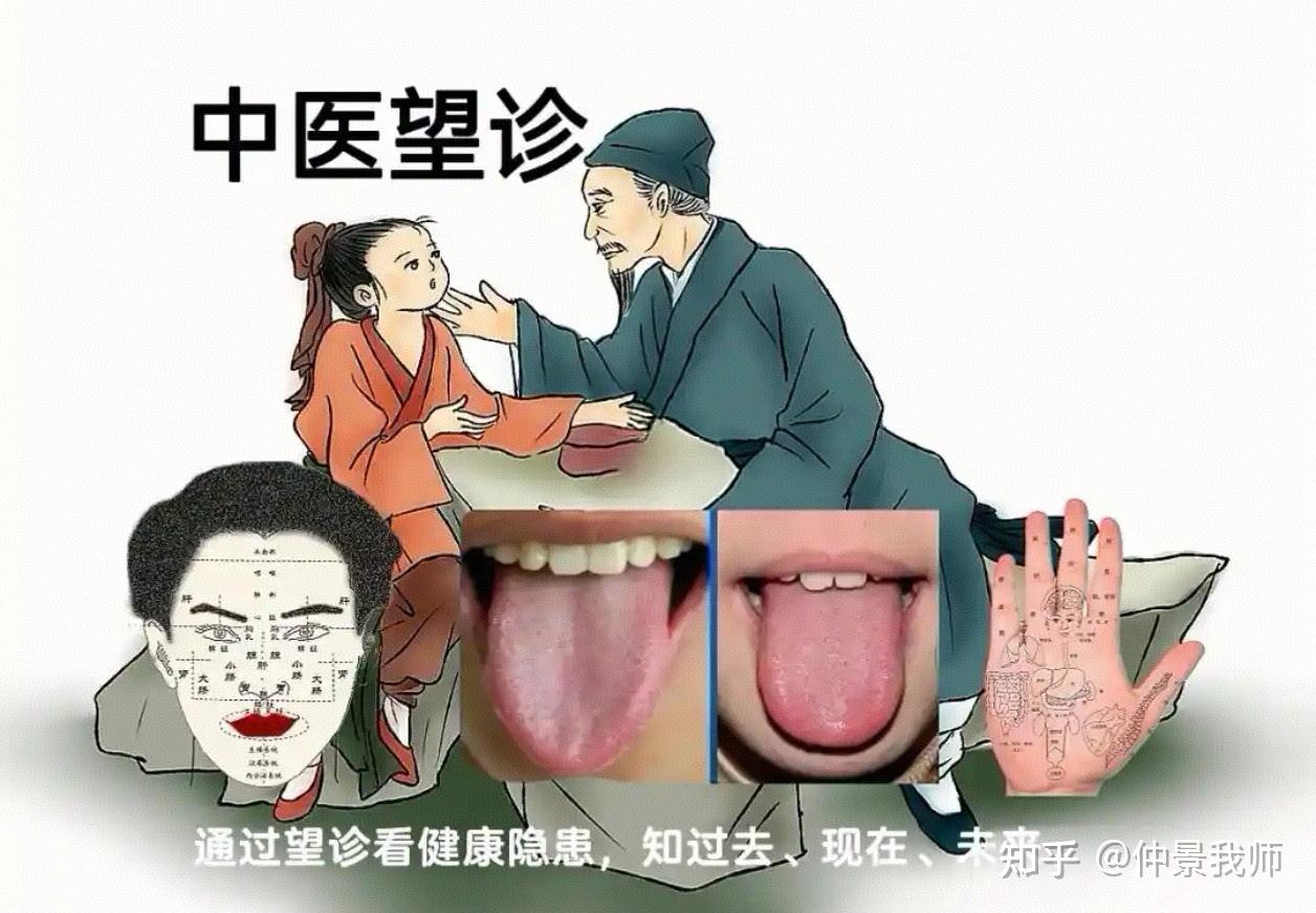 望而知之谓之神：中医望诊的智慧与神奇 - 知乎
