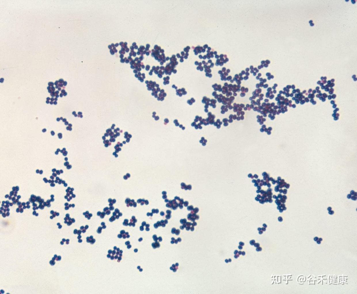 (在設計上與現代放大鏡比現代顯微鏡更相似)在各種物質中看到了微生物