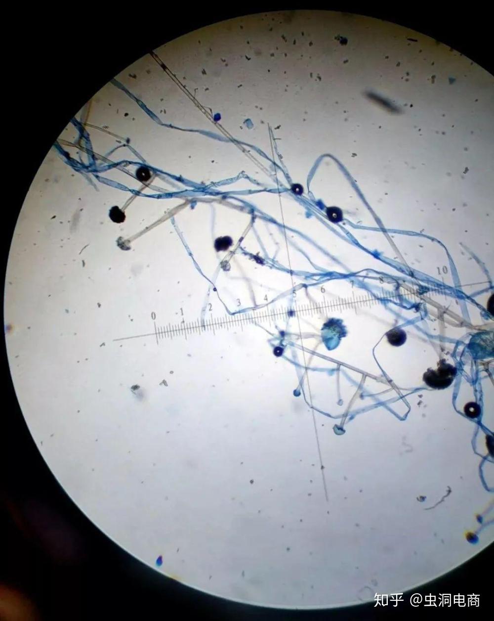 我思故我在:显微镜下的根霉小编:还怪好看呢!