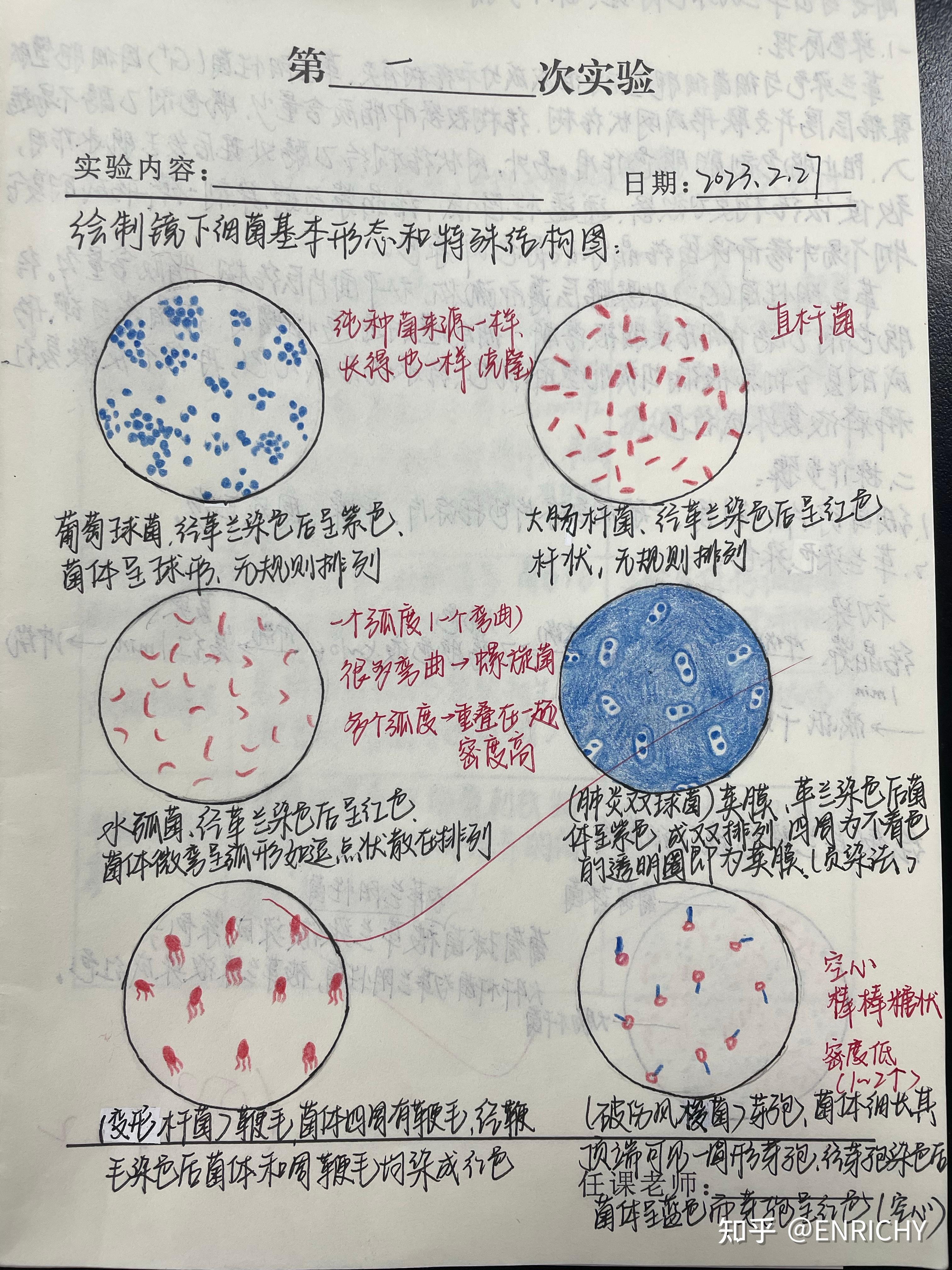 肺炎双球菌的荚膜组成图片