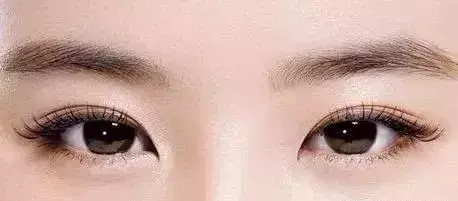 我的眼睛适合开眼角吗适合割平行的还是扇形的双眼皮