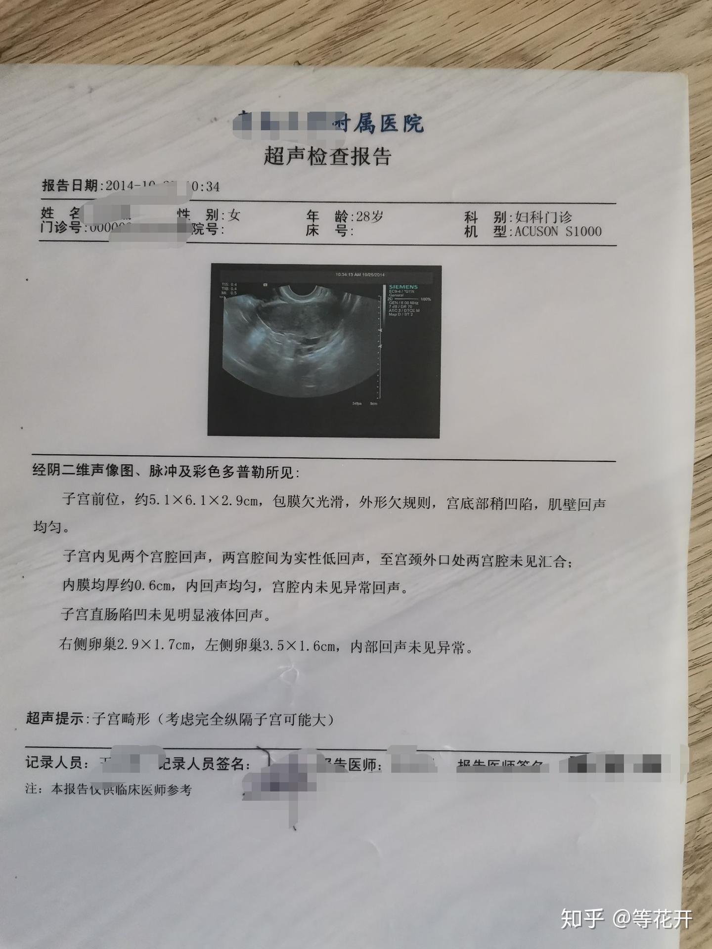 一位纵膈子宫妈妈的自述- 知乎