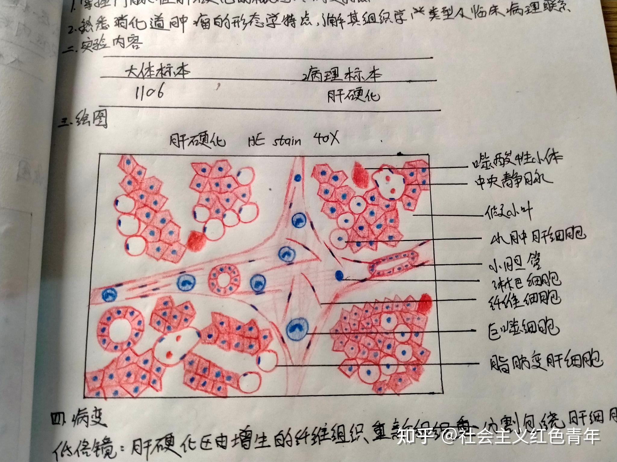 病理学红蓝铅笔绘图