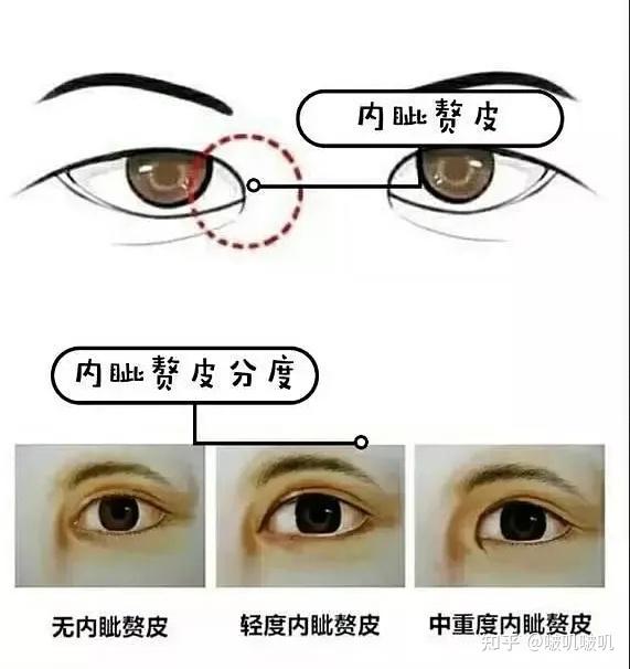 我整容了!割双眼皮前一定要看的肿泡眼整形经验分享 - 知乎