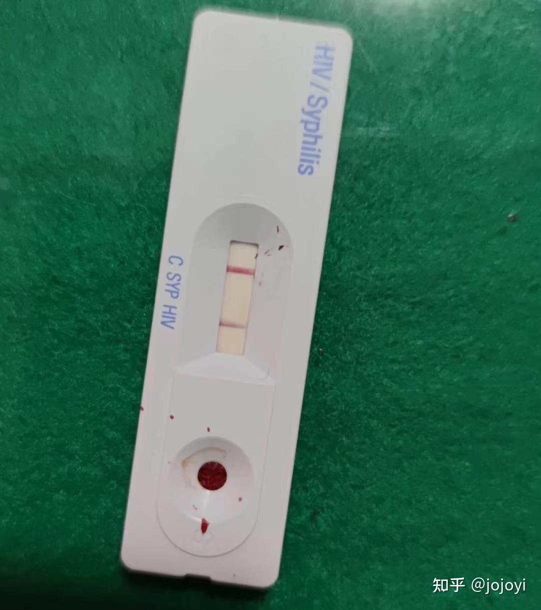 hiv试纸出现假阳性的几率大吗