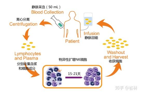 免疫细胞回输图片