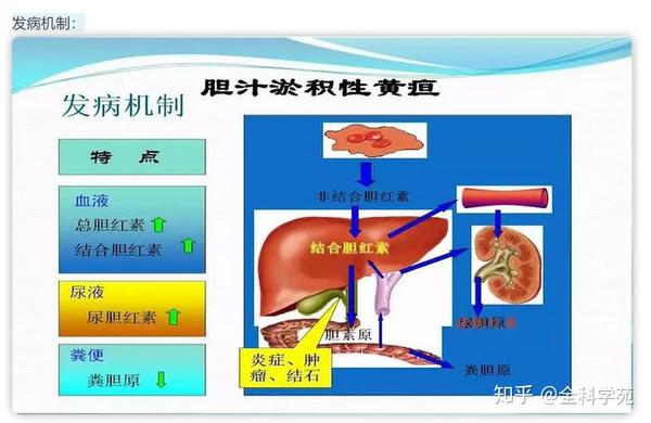 从症状谈疾病系列——黄疸 - 知乎