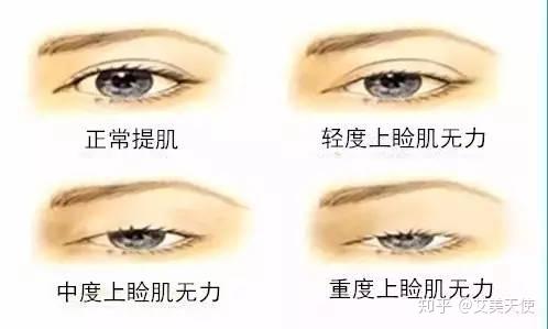v2-24d8fbc15e25ae5aacb52632548279d5_r.jpg