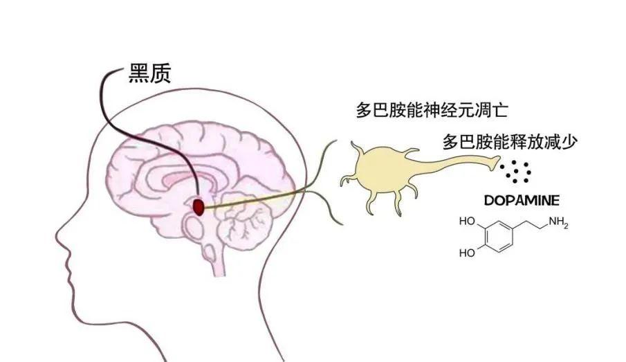 中脑黑质多巴胺图片