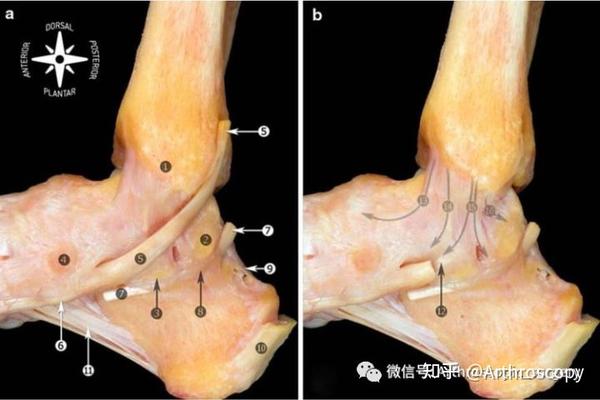 手术基础|踝关节韧带解剖 Anatomy of the ankle ligaments - 知乎