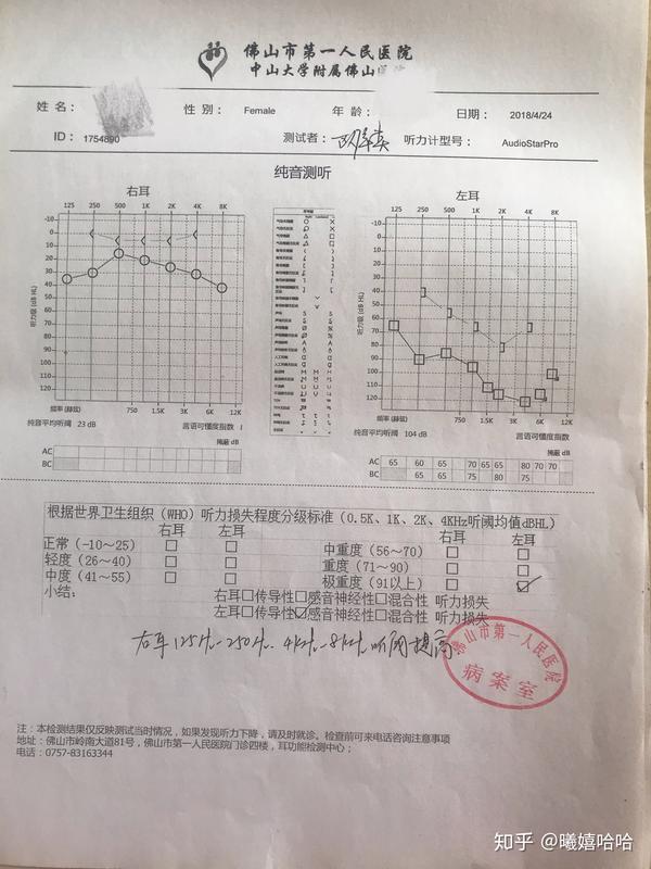 耳膜穿孔修补微创手术