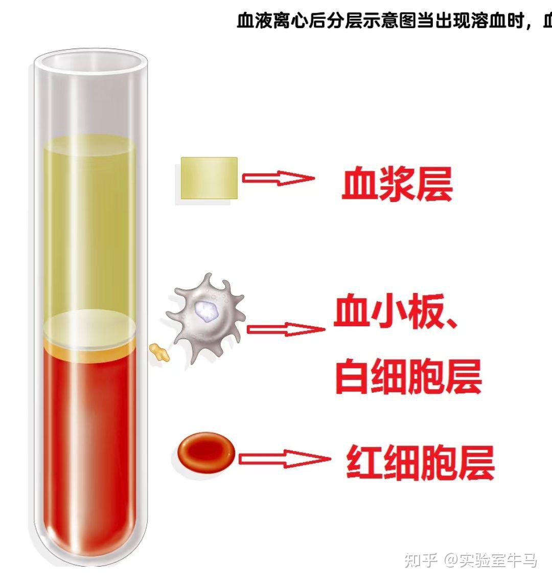 溶血实验知识点汇总，什么是溶血实验？ - 知乎