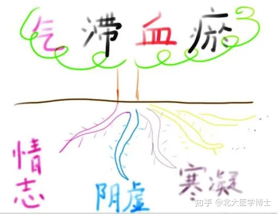 瘀在哪,痛在哪!久病必瘀,久病入络,痛风可活血化瘀从瘀论治 - 知乎