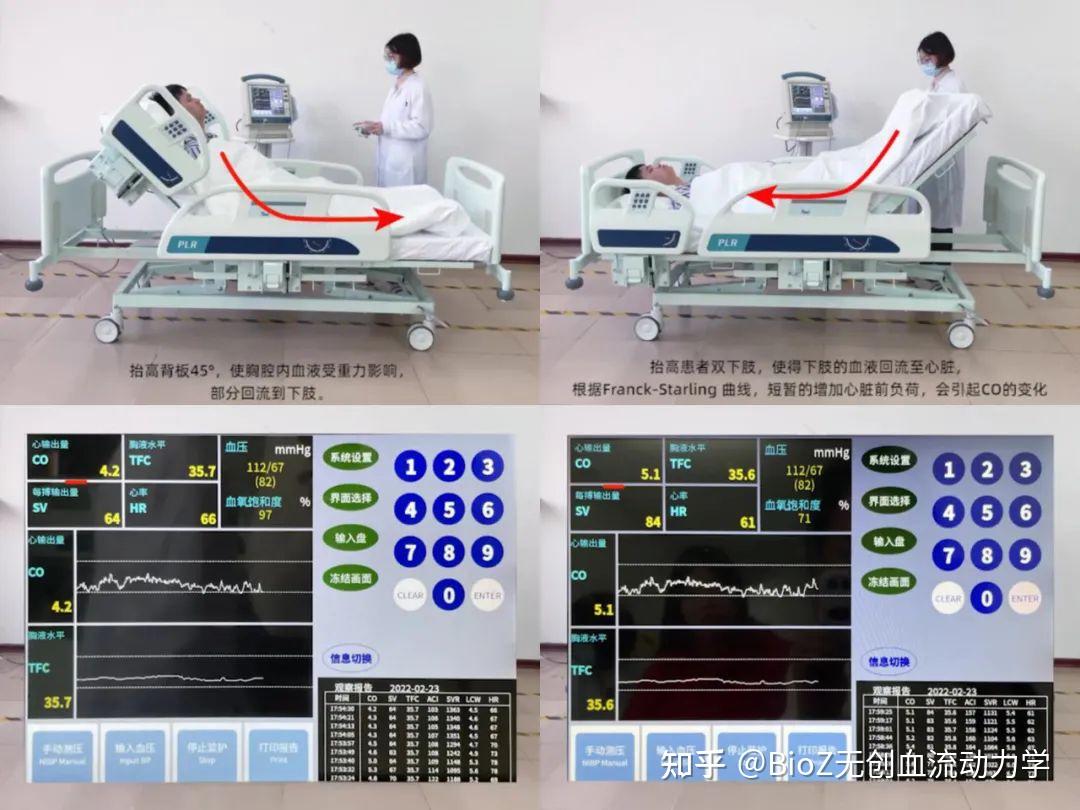 被动抬腿试验 (passive leg raising,PLR) - 知乎
