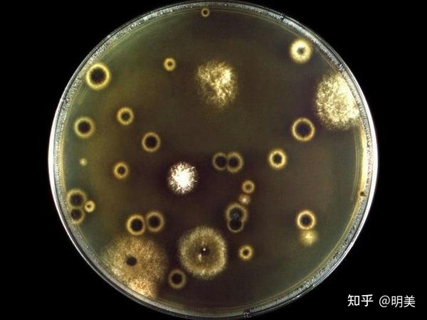 不同种类的真菌用什么显微观察？ - 知乎