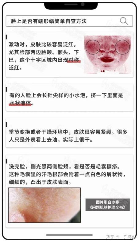 螨皮炎怎么治疗图片