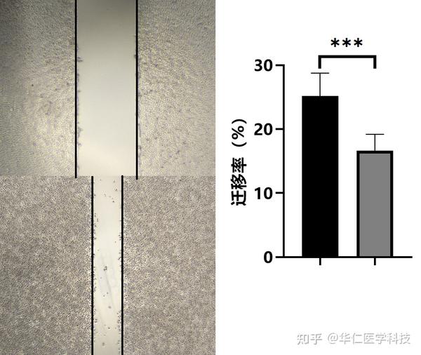 从青铜到王者,科研小白的进阶之路(4)——细胞划痕实验教程 - 知乎