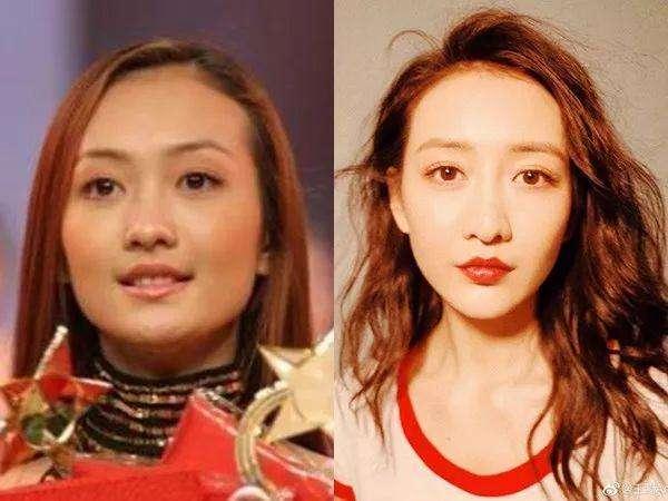 你以为明星的巴掌脸都是天生的吗原来她们都是靠这个