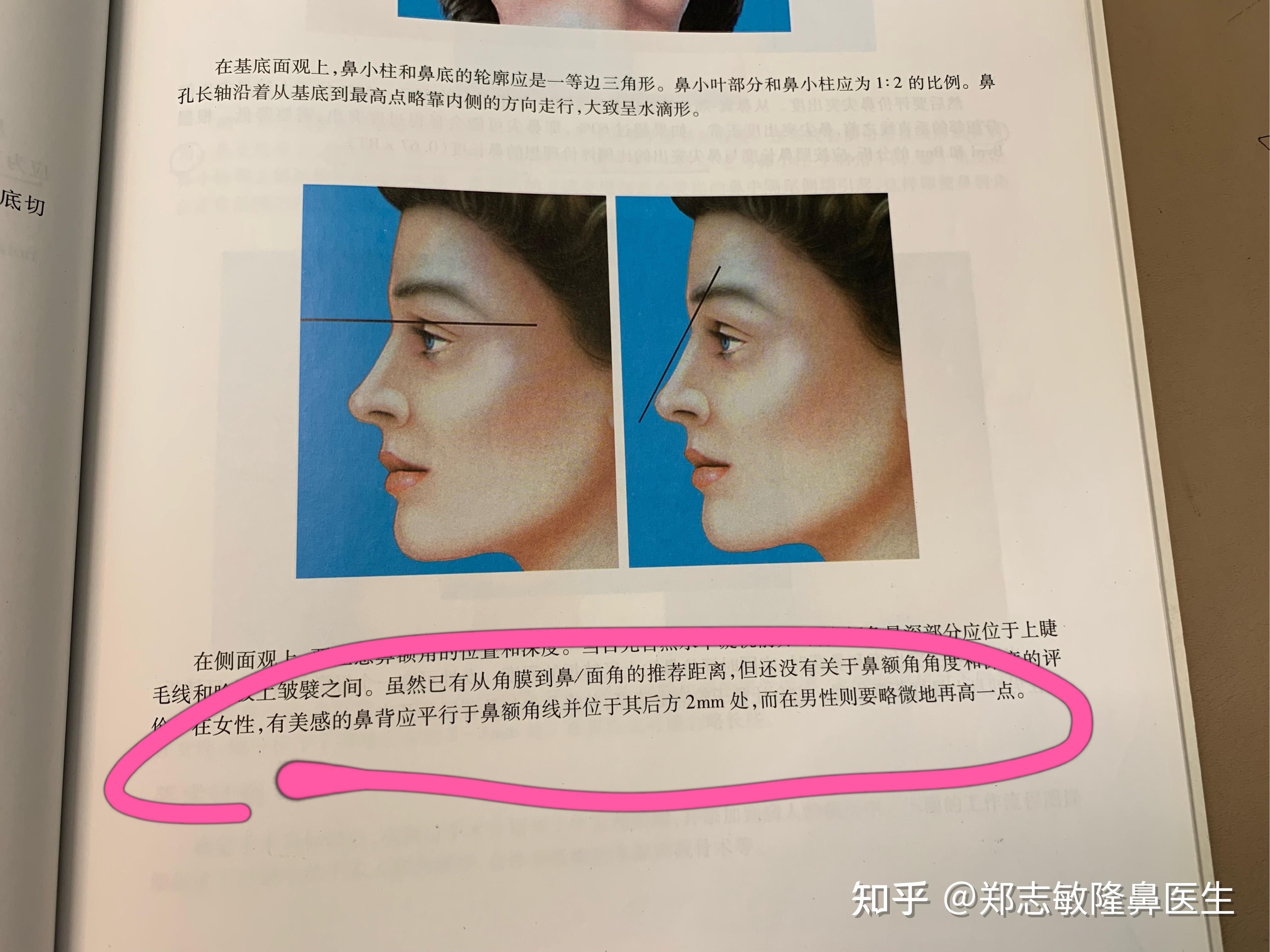 鼻背(鼻梁)高挺的网红鼻,真的好看吗? - 知乎