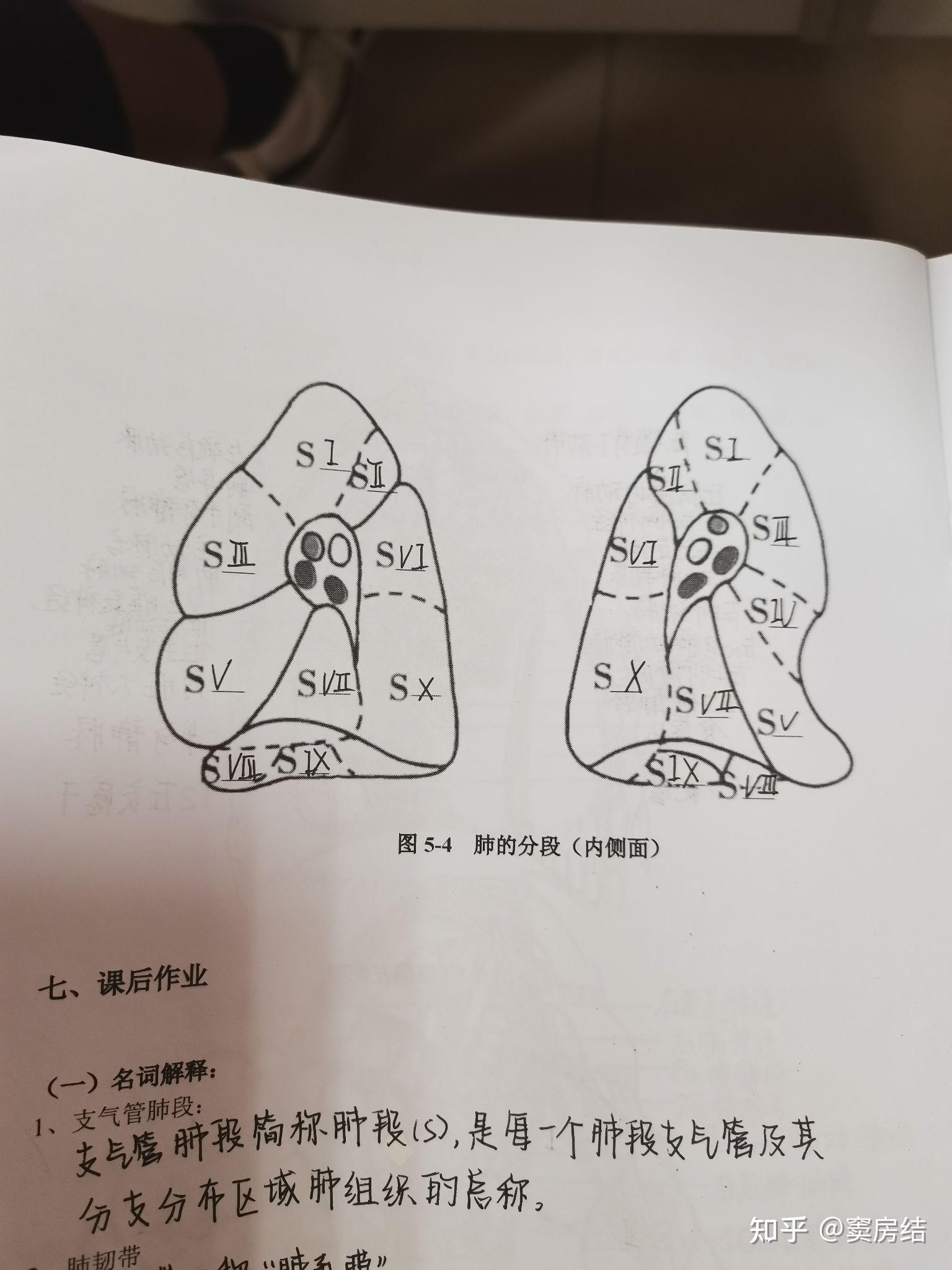 肺部断层 - 知乎