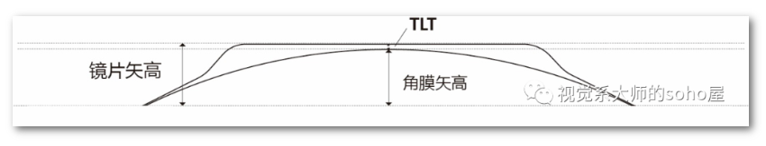 视光冷知识丨矢高设计ok镜的设计思路和数学推演 - 知乎
