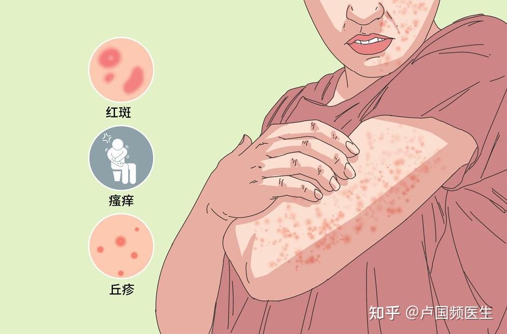 秋季皮肤瘙痒不仅是缺水!医生:盘点5类常见皮肤病,注意预防! - 知乎