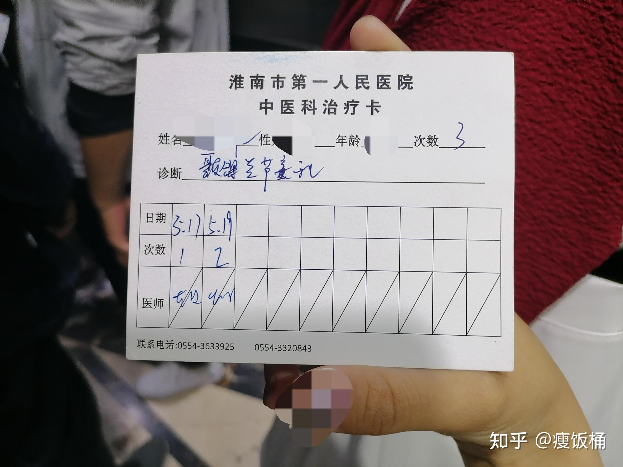 颞颌关节紊乱针灸治疗