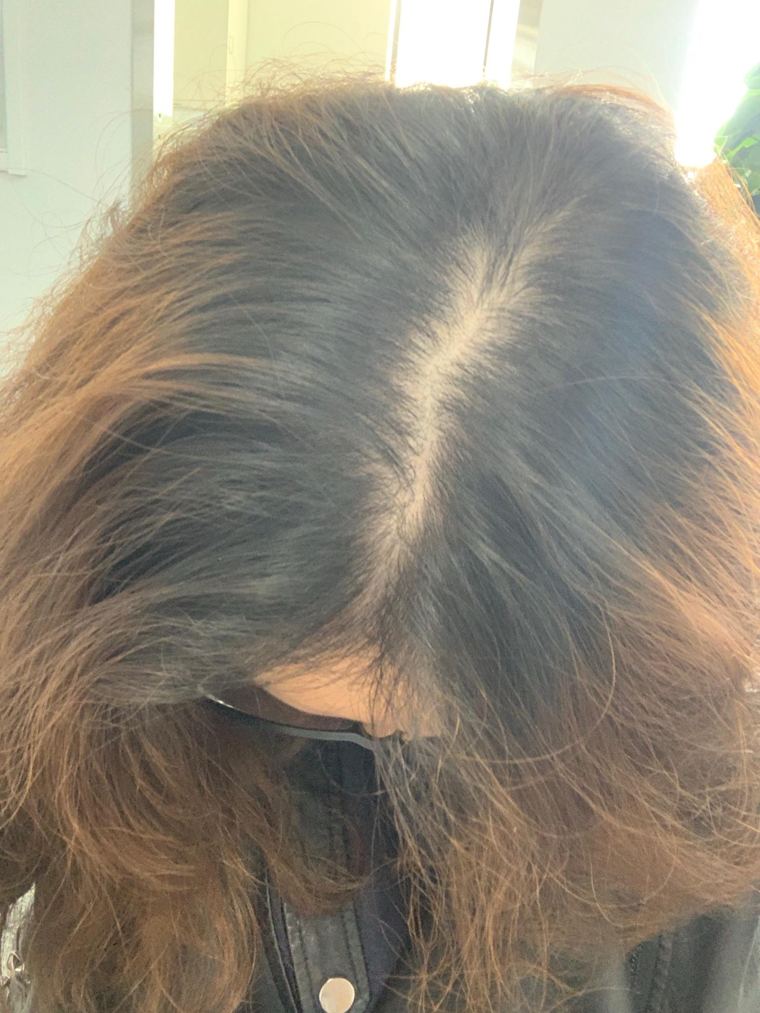 女生这样头顶正常吗