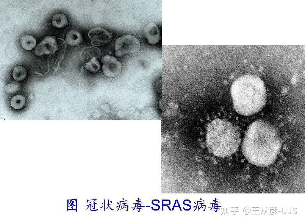 噬菌体:蝌蚪状,丝状.植物病毒:杆状,丝状,球状