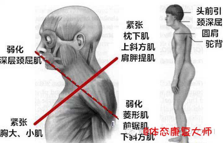 緊張肌肉我們需要去放鬆,無力的肌肉我們要去激活和加強.