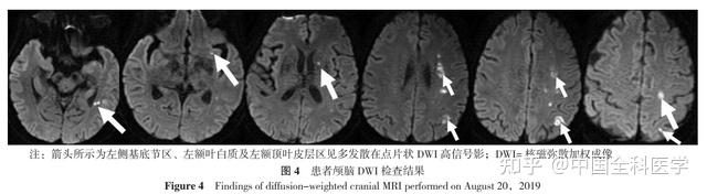 蝶窦炎看什么科挂号(蝶窦炎怎么治疗好?哪个医院治疗好?)