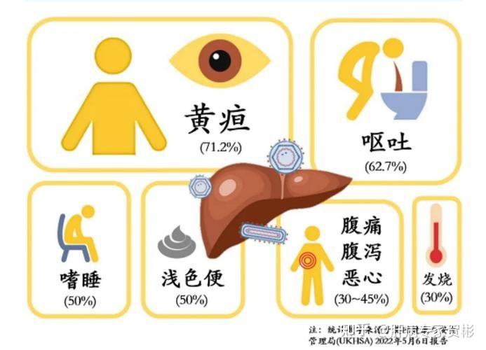 中医如何治疗黄疸型肝炎?3个药方分享给你! - 知乎