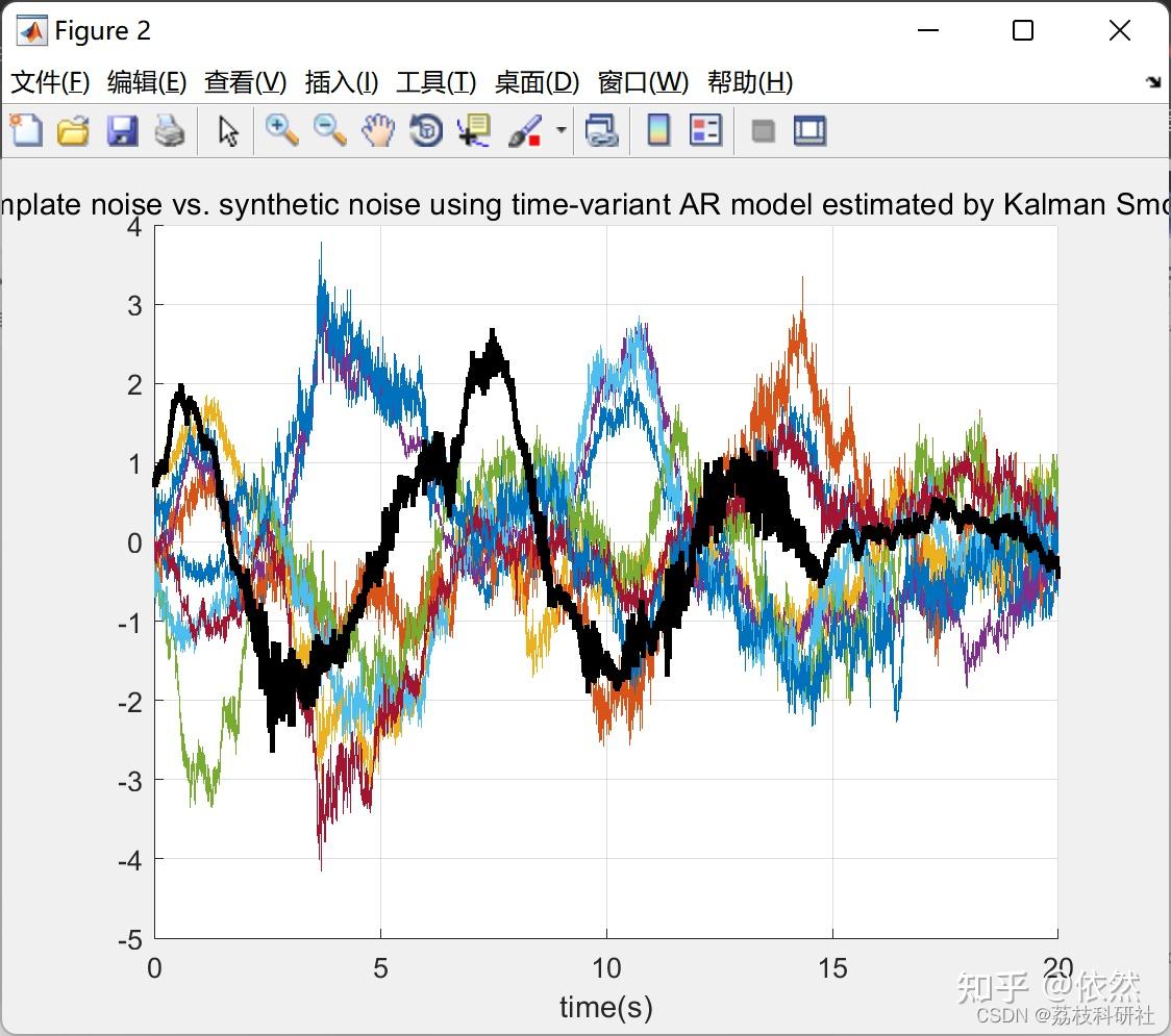 ECG Matlab ecg-matlab