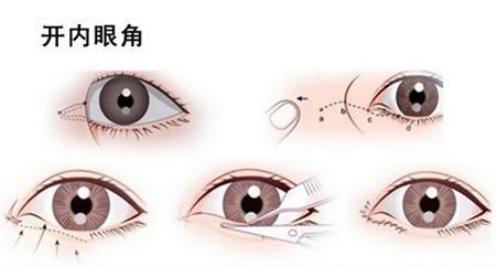 v2-27fd5ae6afe7e0f4dc8239dd449d01ea_1440w.jpg?source=172ae18b