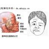 专家访谈 脸上总是抽动 就是面肌痉挛吗 知乎