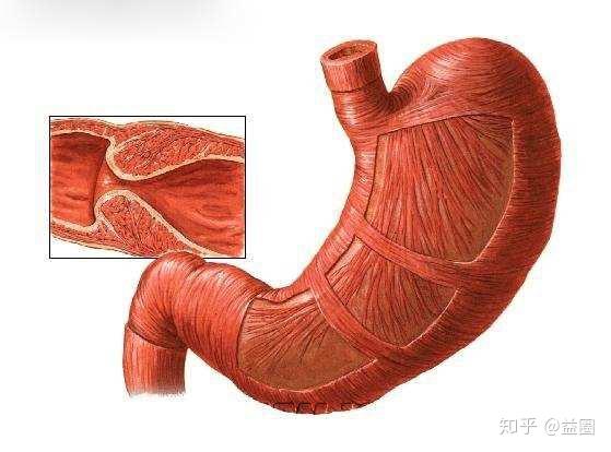 瘢痕性幽门梗阻图片图片