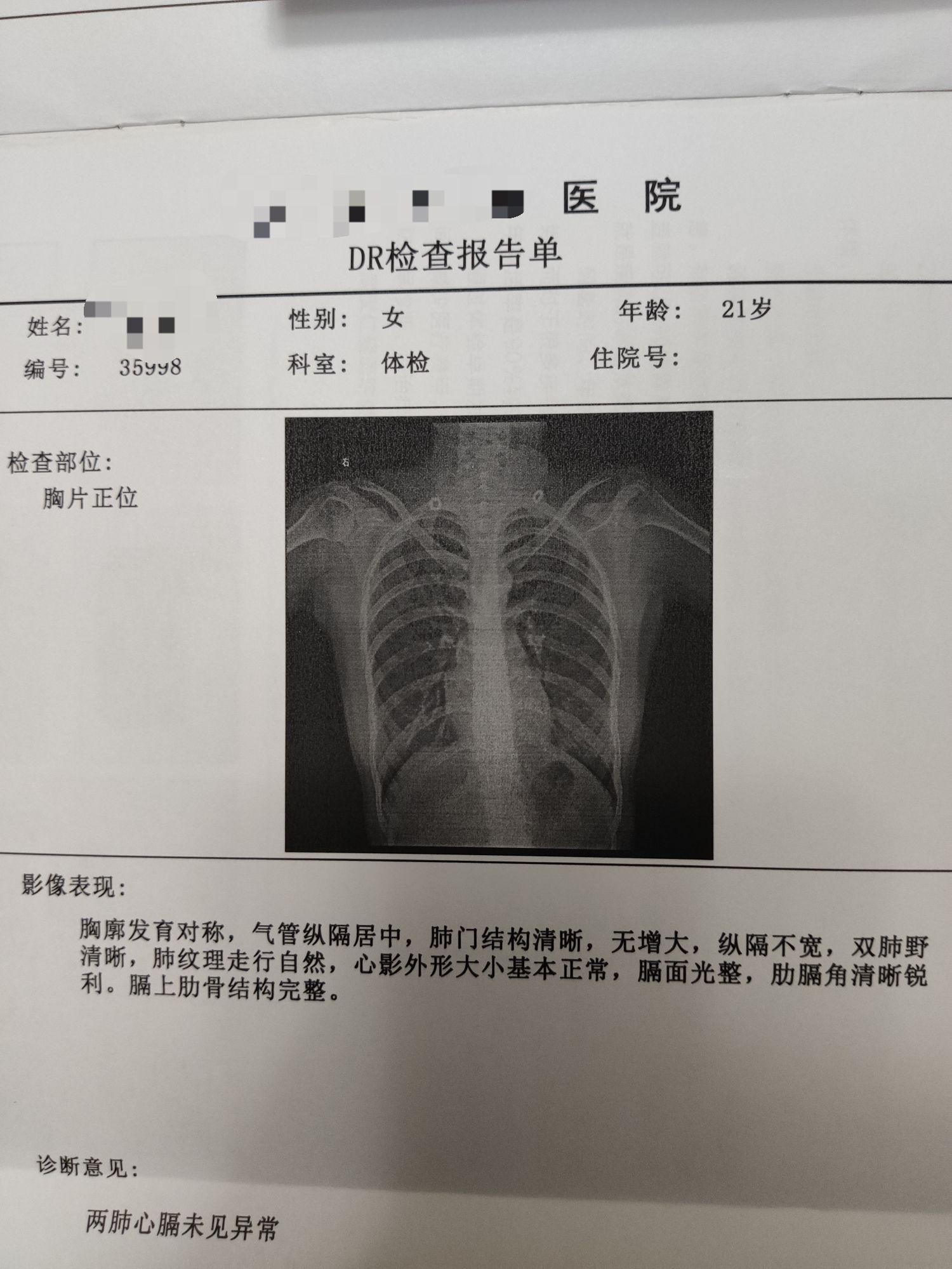 有什么故事?