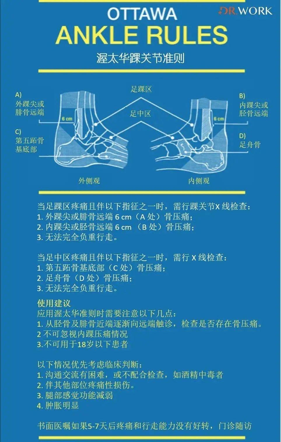 关于脚踝扭伤你需要知道的几件事