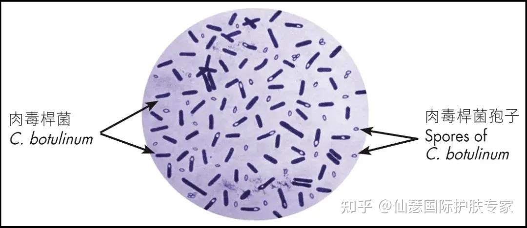 a型肉毒毒素(bont-a) 會阻止神經遞質乙酰膽鹼的釋放,因此有助於撫平