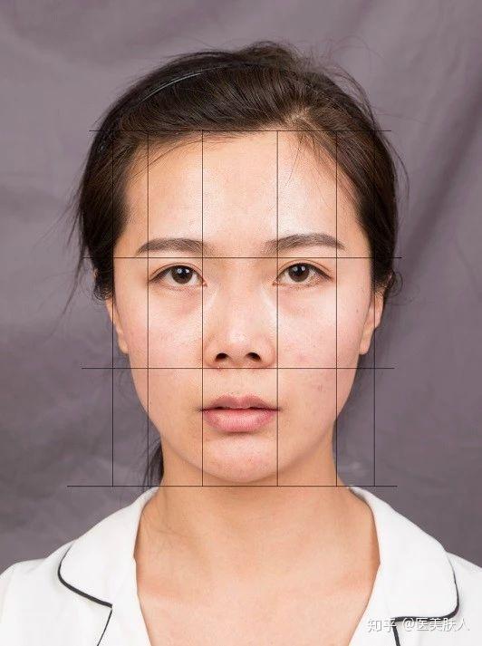 根据每一个求美者的面部比例,严谨且合理的设计隆鼻手术的每一个参数